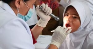 CKG Perkuat Kesehatan Berkualitas lewat Deteksi Dini Gigi Berlubang Anak